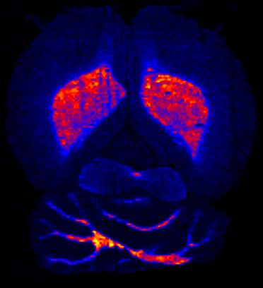 Rat brain seen with the new eguipment.